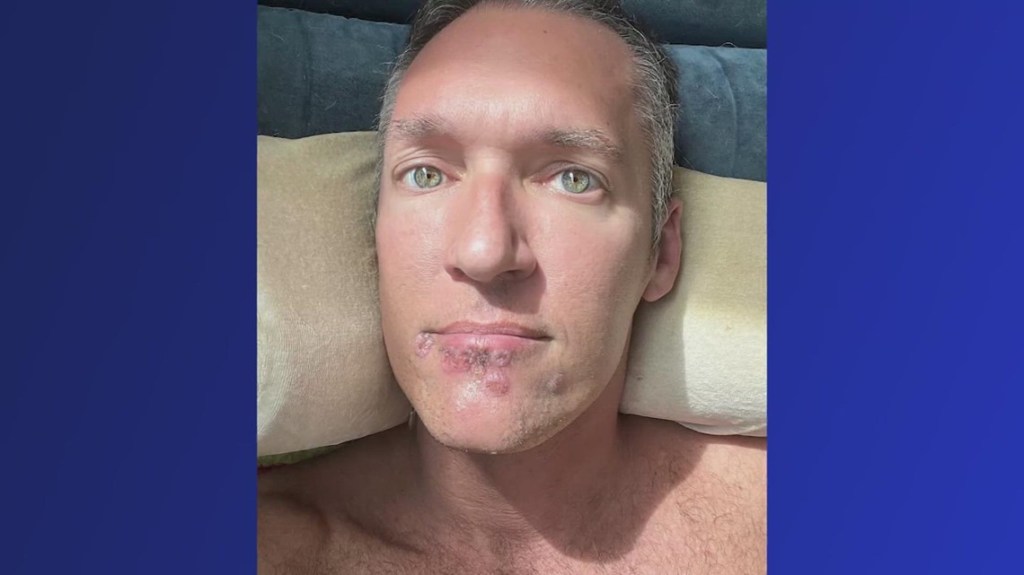 BEFORE & AFTER: WESTLEY&nbsp;WALLACE