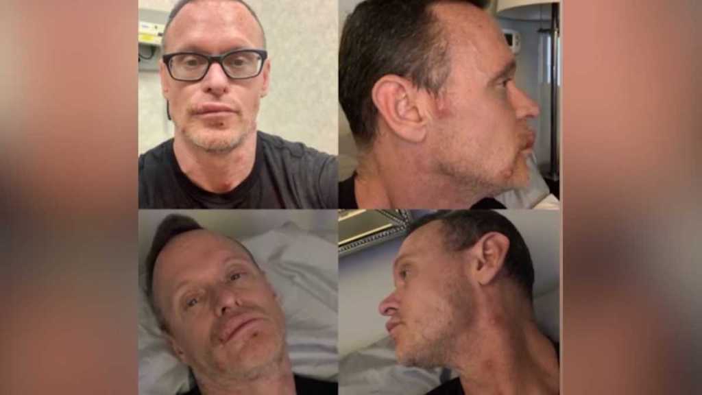 Watch “Massachusetts man shares ‘horrific’ experience with monkeypox” on&nbsp;YouTube