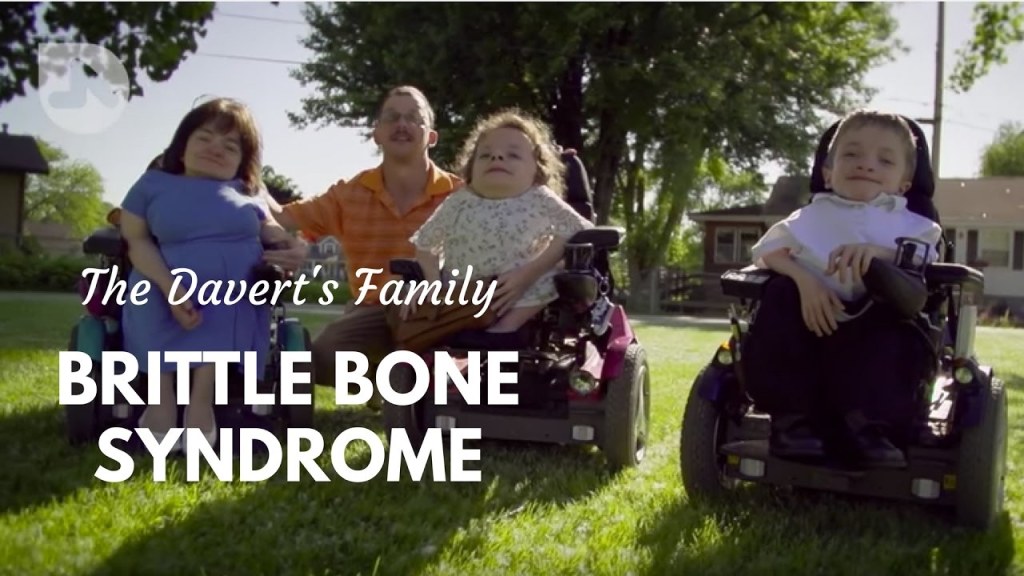 Watch “The Daverts: Brittle Bones & Cerebral Palsy” on&nbsp;YouTube