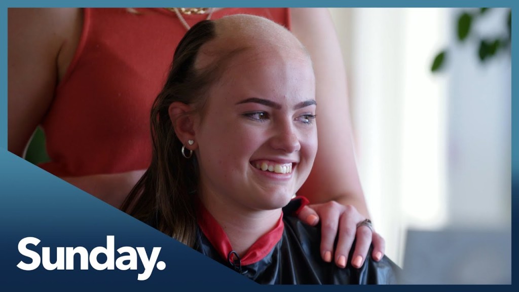 Watch “Living with alopecia: Four women share their journeys” on&nbsp;YouTube