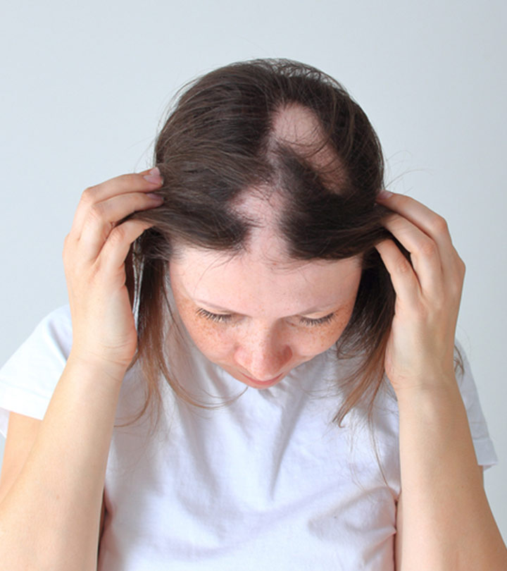 GROUP HEALING: ALOPECIA