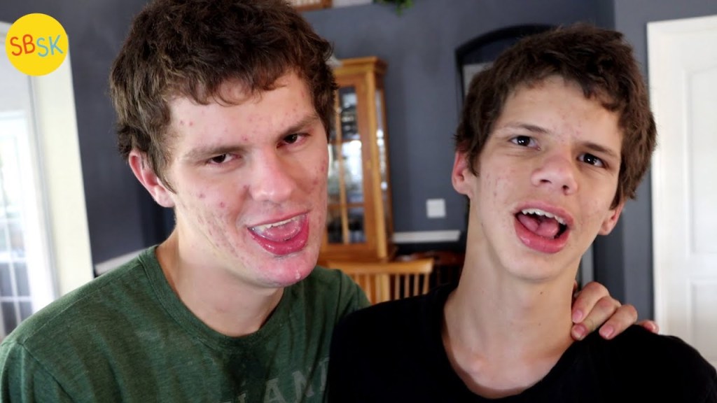 Watch “The Story of 2 Unique Brothers (2 of Only 150 Known Cases)” on&nbsp;YouTube