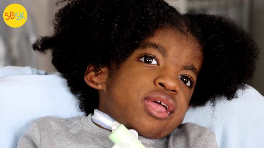 Watch “A Kid Denied Life Saving Treatment (Because He’s “Incompatible with Life”)” on&nbsp;YouTube