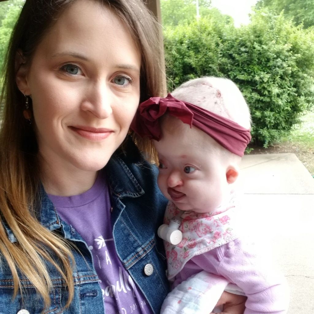 Watch “Josie’s Joyful Life (One Of the World’s Rarest Syndromes)” on&nbsp;YouTube