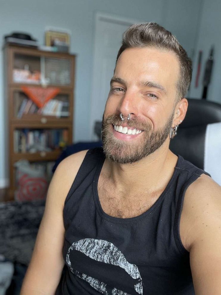 Watch “Monkeypox patient shares diagnosis in effort to raise awareness l ABC News” on&nbsp;YouTube