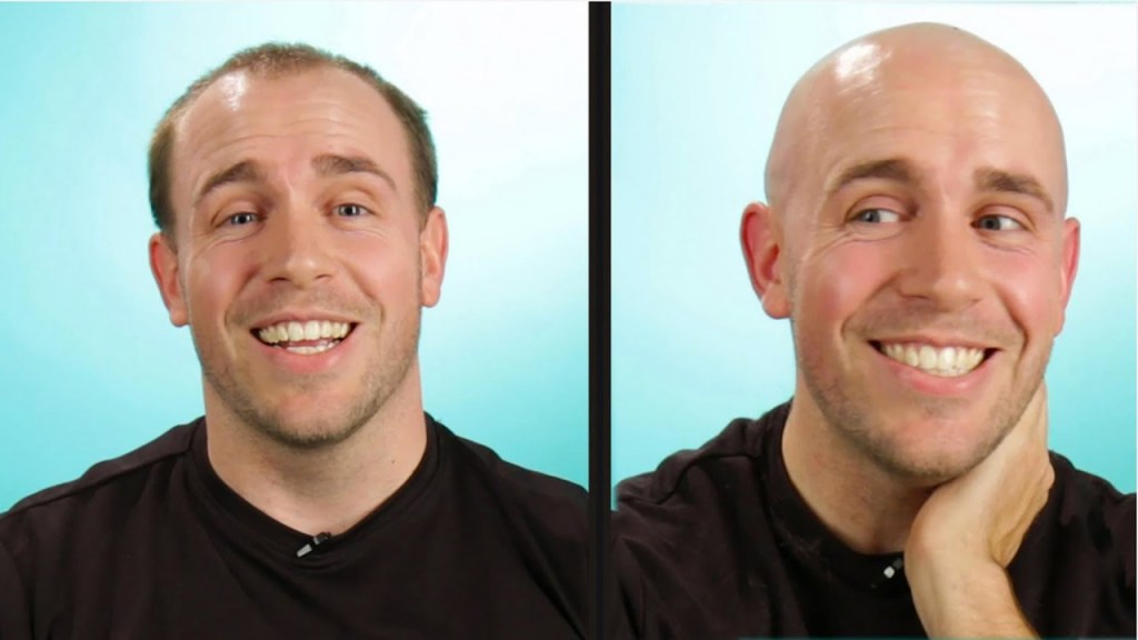 Watch “Balding Guys Go Completely Bald” on&nbsp;YouTube