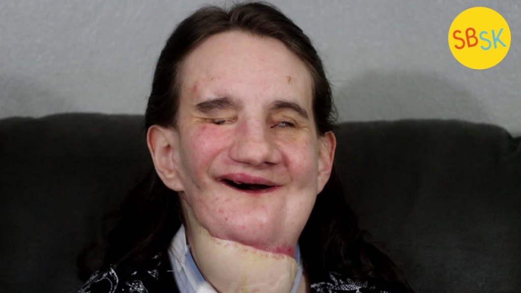 Watch “A Blind Mom with a Facial Difference” on&nbsp;YouTube