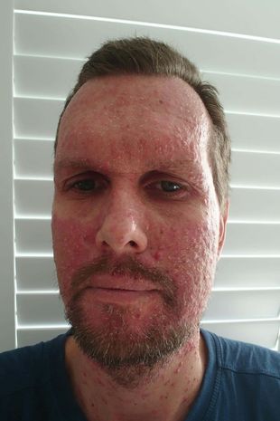 Watch “Bowel cancer symptom: Seemingly fit man with stage 4 cancer shares his first sign” on&nbsp;YouTube