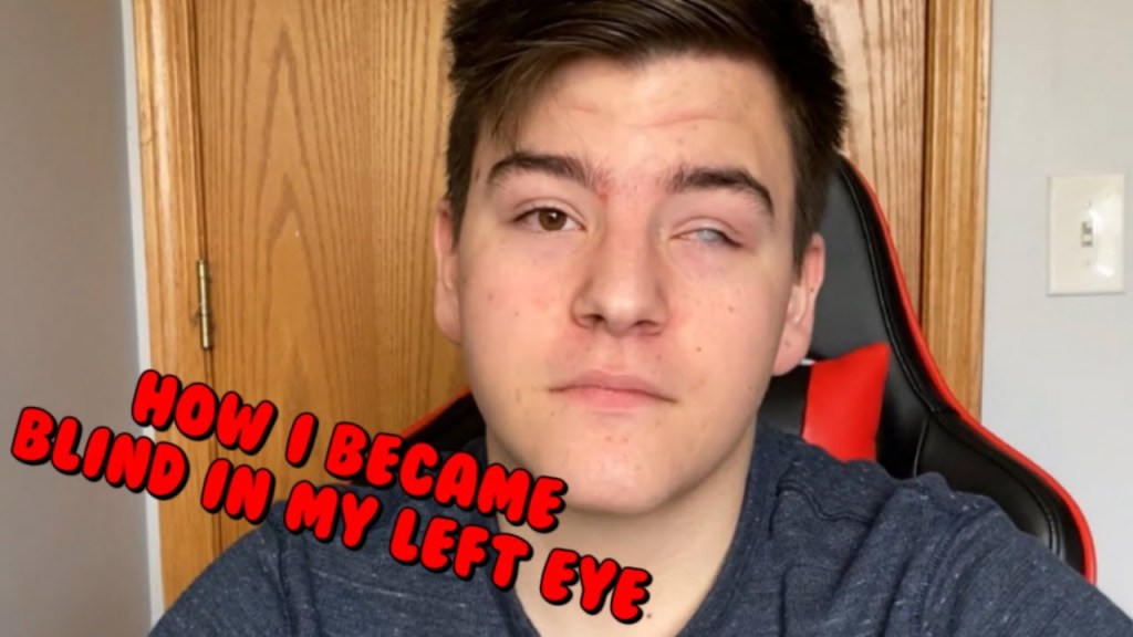 Watch “What It Is Like To Be Blind In One Eye.” on&nbsp;YouTube
