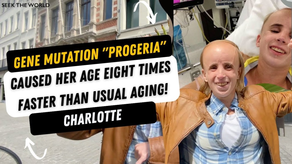 Watch “Progeria Genetic Mutation: Ages Deaf Person 8 Times Faster!” on&nbsp;YouTube
