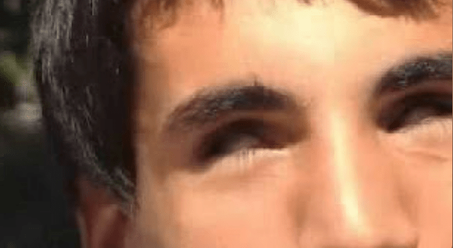 Watch “Blind / Blindness / Visual Impairment 1” on&nbsp;YouTube